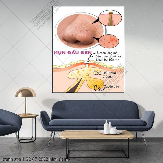 tranh spa 1 22 07 2022 hieu